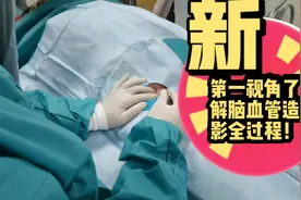 第一视角了解脑血管造影过程！视频封面
