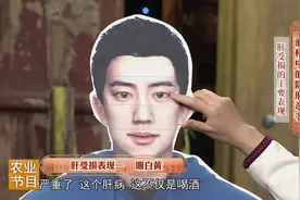 喝酒会让肝脏受损，来看看你有没有这五个表现