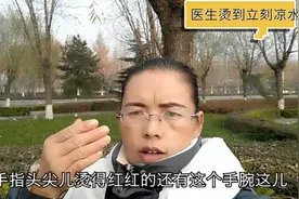 医生朋友说烫到立刻凉水冲15分钟，今天煎饼姐手不幸被烫验证效果