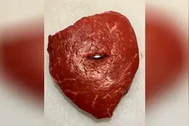 视频模拟了儿童误吞电池的严重后果，家长一定要看好自己的孩子