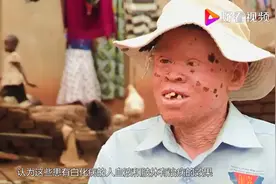 世界上最“贵”的人，血液比黄金还贵视频封面