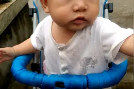 九个月了头上咋还有坑？视频封面