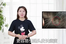 头皮长包是什么原因？躲不开这3种疾病！惹上一个，都很“麻烦”