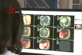 女孩呕吐恶心 检查发现是胃里“长”了头发