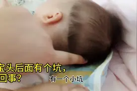 70天的宝宝头后面有个坑，妈妈吓的赶紧带去医院，听听医生怎么说视频封面