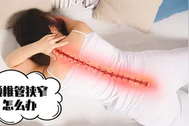 颈椎管狭窄怎么办？专家推荐的治疗方法，最好早知道视频封面