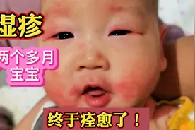 宝宝湿疹终于痊愈了，这个煎熬的过程结束，分享经验给大家！视频封面