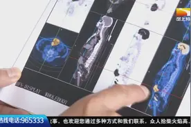 7旬老人全身瘙痒难忍，到处求医无果，通过CT一查原是肿瘤作怪视频封面
