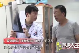 胸中异物被取出，竟是如此的诡异样貌，针状异物从何而来