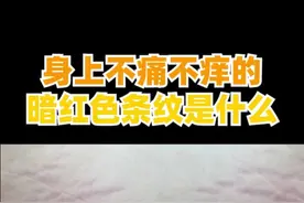 身上不痛不痒的   暗红色条纹   是什么？视频封面