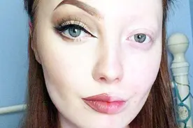 割了双眼皮的女人，10年后眼睛变成什么样？今天终于知道了视频封面