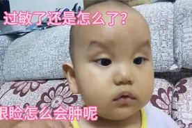 孩子下眼睑肿了，把妈妈吓得够呛，看看是咋回事！视频封面