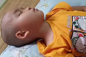 四岁的孩子每晚汗流不止，一个月暴瘦五斤，当妈的都看不得