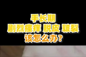 手长期剧烈瘙痒、脱皮、皲裂，该怎么办？