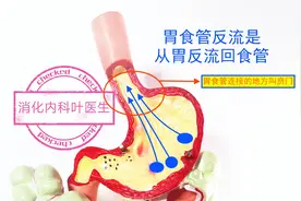 抽烟喝酒为什么会引起反酸、烧心？该如何保养？消化科医生告诉你