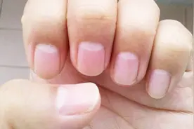 指甲上的月牙，真的是越大越好吗？我也才看见，别怪没有提醒你视频封面