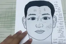 “贵人不顶重发”是真的吗？头屑头油代表什么呢？视频封面