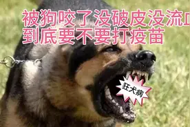 被狗咬了没破皮没出血要不要打疫苗今天总算知道了视频封面