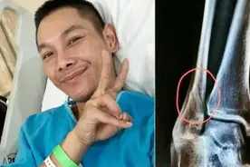 男艺人“公主抱”166斤女歌手！当场被对方坐断腿？还要打石膏！视频封面
