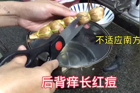 老公不适应南方气候，后背痒长红痘 买了这个东西 不知有没有效果视频封面