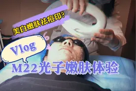 硬核体验！美白嫩肤祛痘印？M22光子嫩肤自体验！视频封面