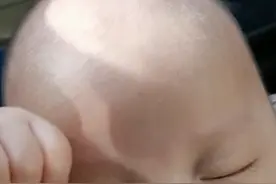 婴儿的头就像会“呼吸”，所有不要摸视频封面