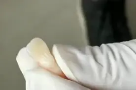 牙科“抽牙神经”过程，钻牙根管治疗！
