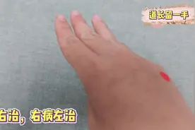 头部左侧疼痛如何解决？【道长留一手】视频封面