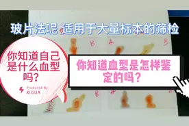 你知道自己是什么血型吗？知道血型是怎样鉴定的吗？快来看看吧！