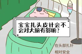 宝宝扎头皮针会不会对大脑有影响？