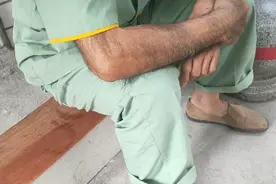 长毛人，第一次看到毛这么长的，这是为什么？视频封面