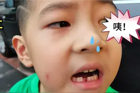 小孩第一颗牙齿就这么掉了！看看这个牙齿是怎么弄掉的！