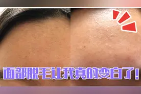 宝妈1800入手激光脱毛仪，半夜偷偷躲在房间里脱毛，效果惊人视频封面