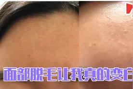 宝妈1800入手激光脱毛仪，半夜偷偷躲在房间里脱毛，效果惊人视频封面
