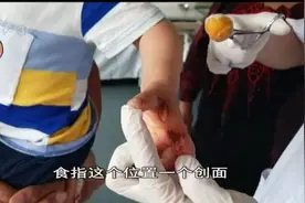 两岁男童右手握螺丝刀，左手拿着裸露电线，结果一碰手被烧焦视频封面