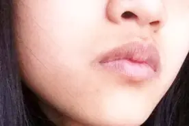 嘴唇周围发黑怎么回事？我也是今天刚看到，可别不当回事了视频封面