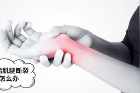 手指肌腱断裂，莫心急，听医生教你如何处理，别耽误了最好时机视频封面