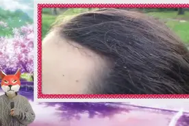 原来头上长虱子是这样来的视频封面