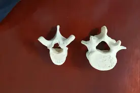 胸椎和腰椎的解剖视频封面