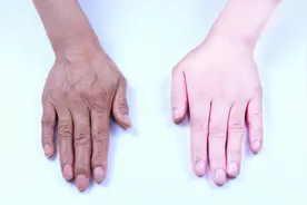 手部粗糙暗黄老十岁？快速嫩白法，一个晚上让小手婴儿般白皙嫩滑视频封面