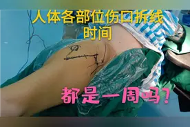 骨科医生告诉你，人体不同部位手术后的拆线时间！