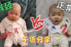 斜颈宝宝头往一侧歪，在家这样锻炼，亲测有效纯干货分享视频封面