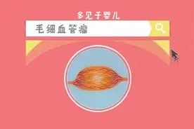 血管瘤是怎么回事？血管瘤的治疗方法有哪些？视频封面