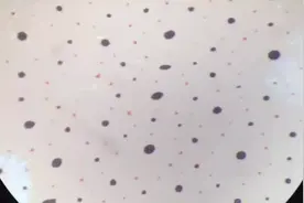 显微镜下的鱿鱼皮肤真的可以变成显示器视频封面