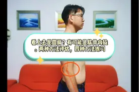 圆肩，肩关节后有凹窝，肱骨前移了？两种观察方法，四个姿势改善