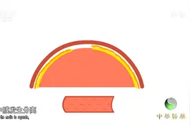 马凡氏综合征为何会导致猝死？看看这个动画，你就明白了视频封面