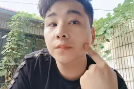 脸上出的油上面有螨虫吗？用显微镜放大后，看完放心了视频封面