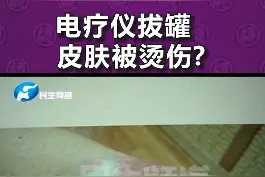 女子在汗蒸馆电疗仪拔罐，回去后疼的睡不着，去医院一检查吓蒙了视频封面