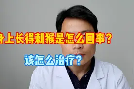 #健康知多少#身上长的刺猴是怎么回事？该怎么治疗？视频封面