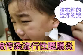 没发烧，耳朵后面腮帮子疼，是流行性腮腺炎？敷了仙人掌视频封面